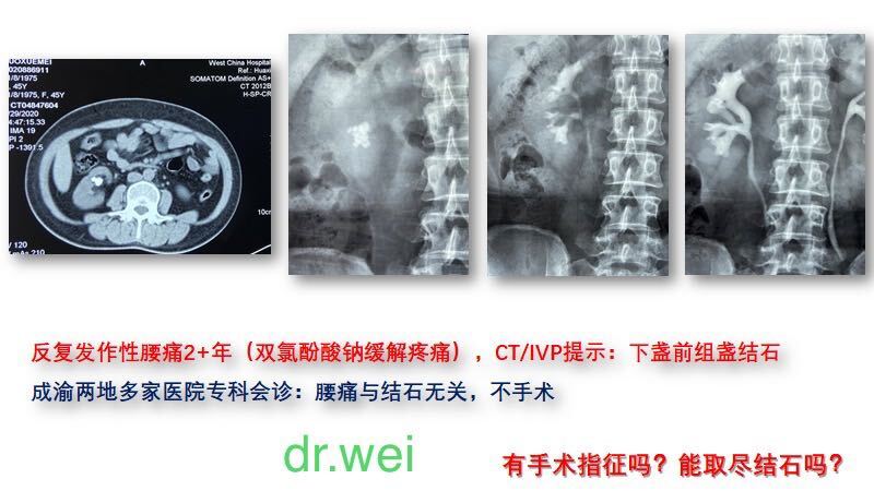 每日发作时间无明显特征,但自述口服"双氯芬酸钠或双氯芬酸钠栓剂"