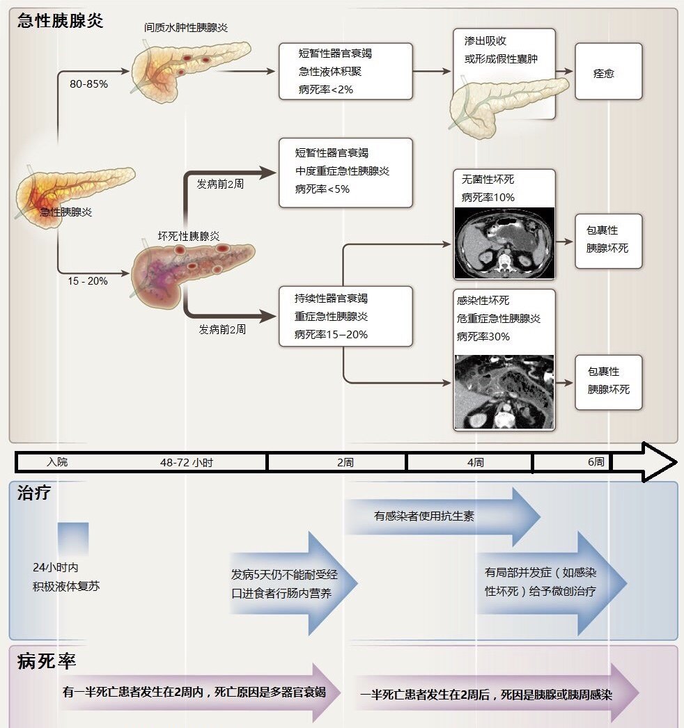 浅谈重症急性胰腺炎的发病机制