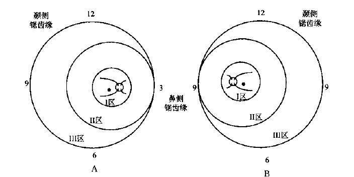 孩子早产要注意预防早产儿视网膜病变