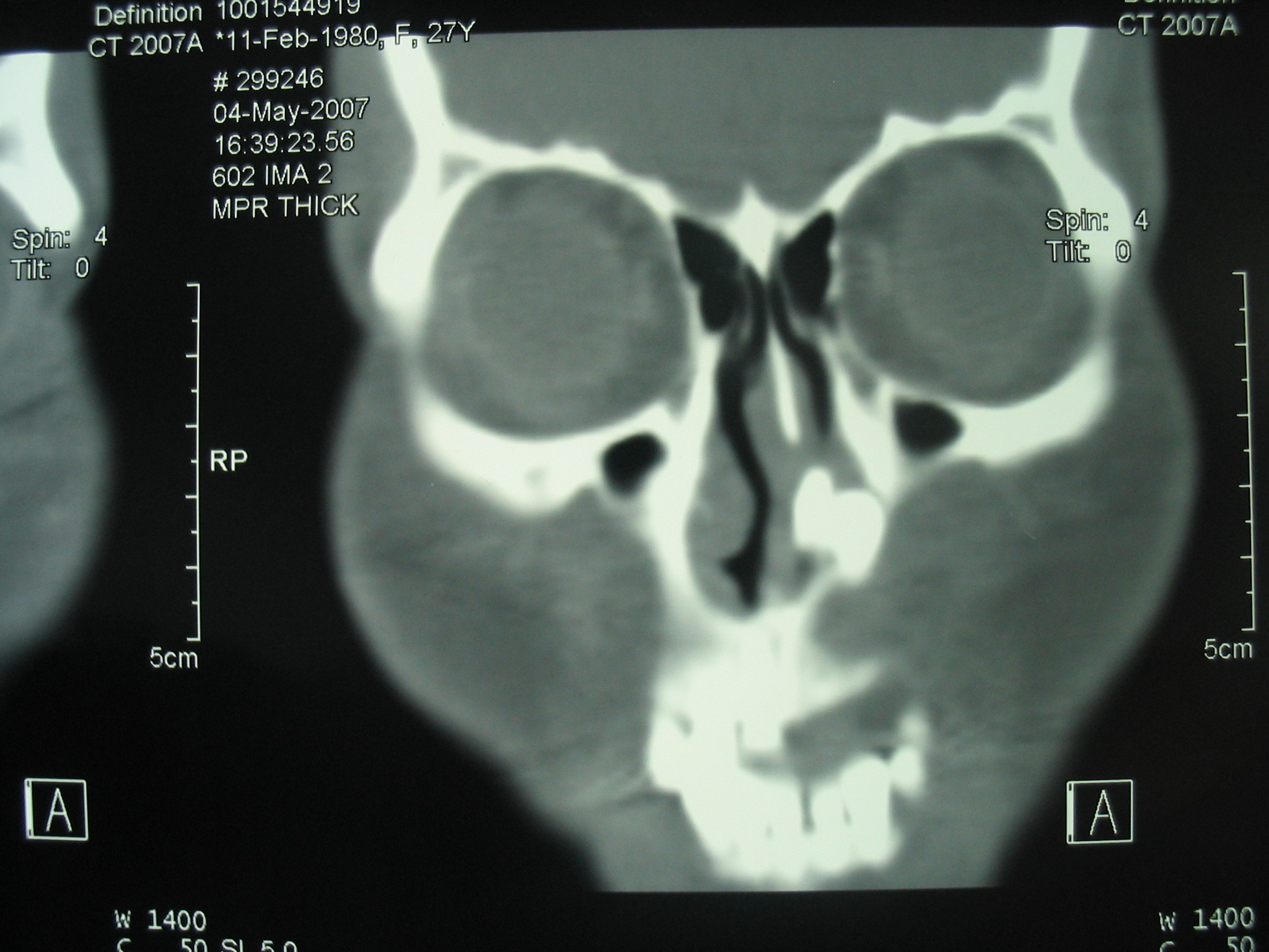 颅脑 CT 读片 纯干货 - 影像医学和核医学讨论版 -丁香园论坛