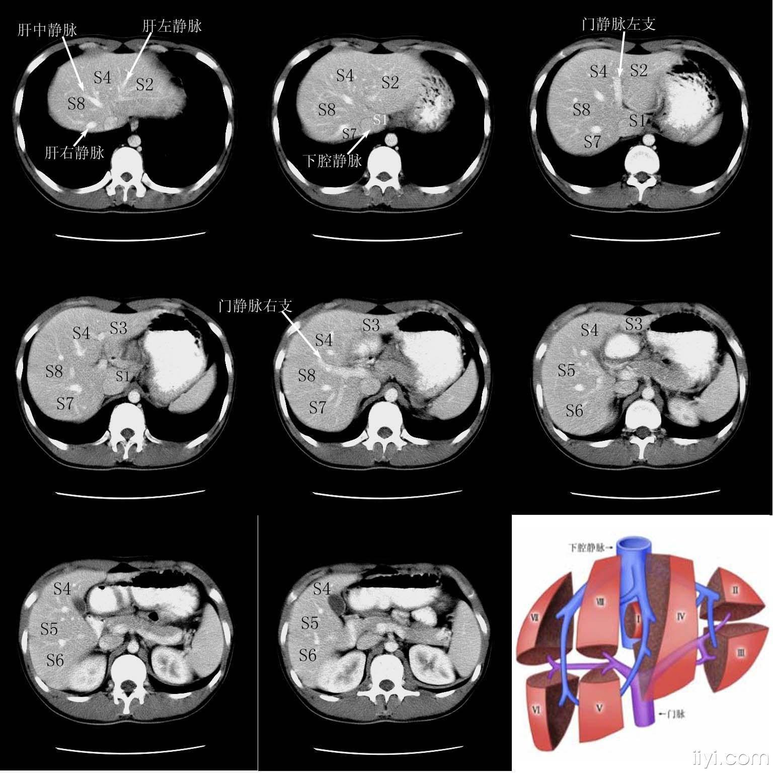 肝脏的分叶分段