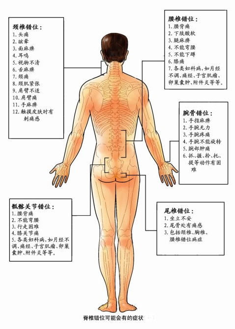 空间 中国 错位/腰椎横突尖压痛点——第12肋骨下缘压痛点——腰椎棘突端和骶中...