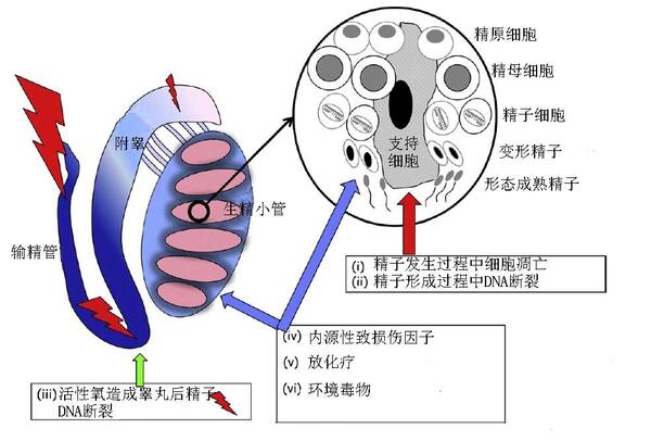 精子DNA完整性(DFI)检测与反复流产的关系。