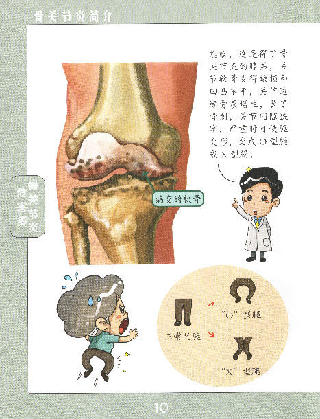 人工全膝关节置换手术指南