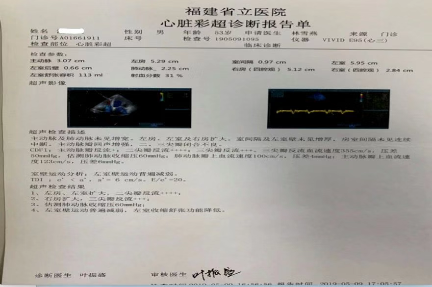 从一个病例学习心律失常性心肌病