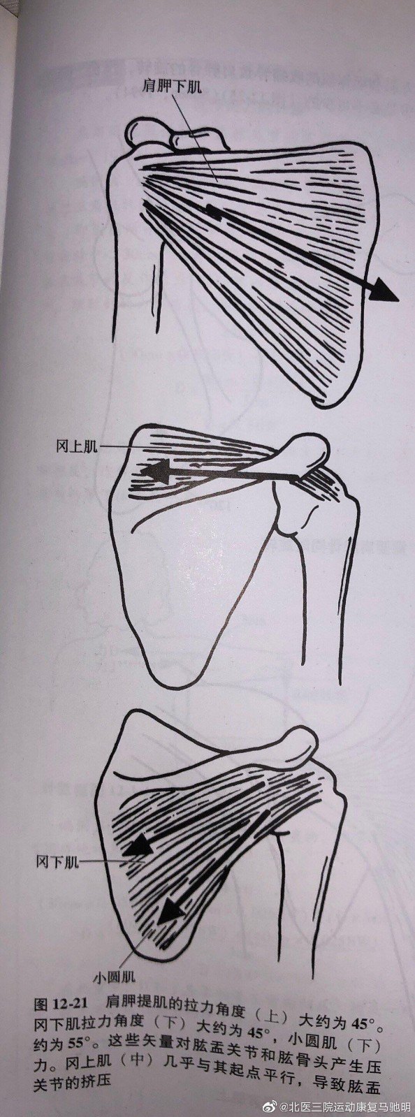 肩关节由盂肱关节,肩锁关节,胸锁关节和肩胛胸壁关节以及附着其上的