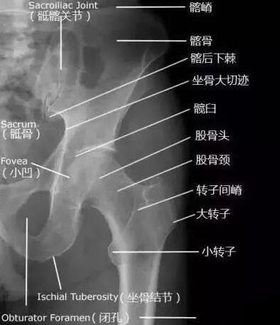 (2)骨盆的x线解剖骨盆一般投照前后位,检查骶,尾骨时可加照侧位,检查