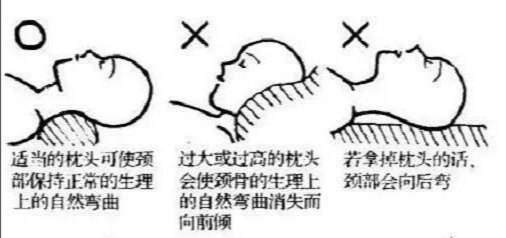 颈椎病枕头选择