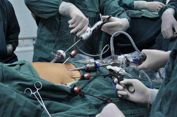 福建省协和医院胸外科行完全胸腔镜联合腹腔