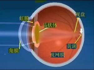 白内障是怎么回事?