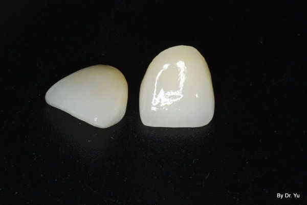 前牙美学修复 瓷贴面 Vs 全瓷冠 - 好大夫在线