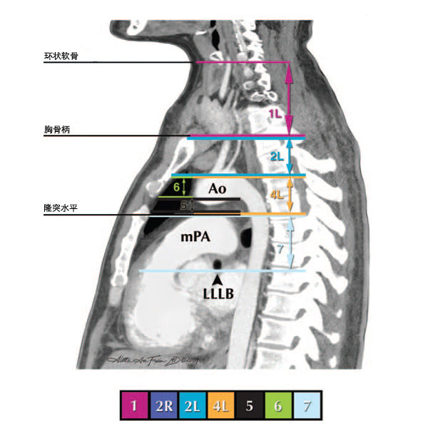 纵隔淋巴结分区图谱美国胸科协会