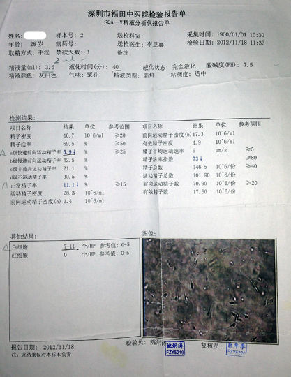 弱精子症,用药2周好转,4周正常
