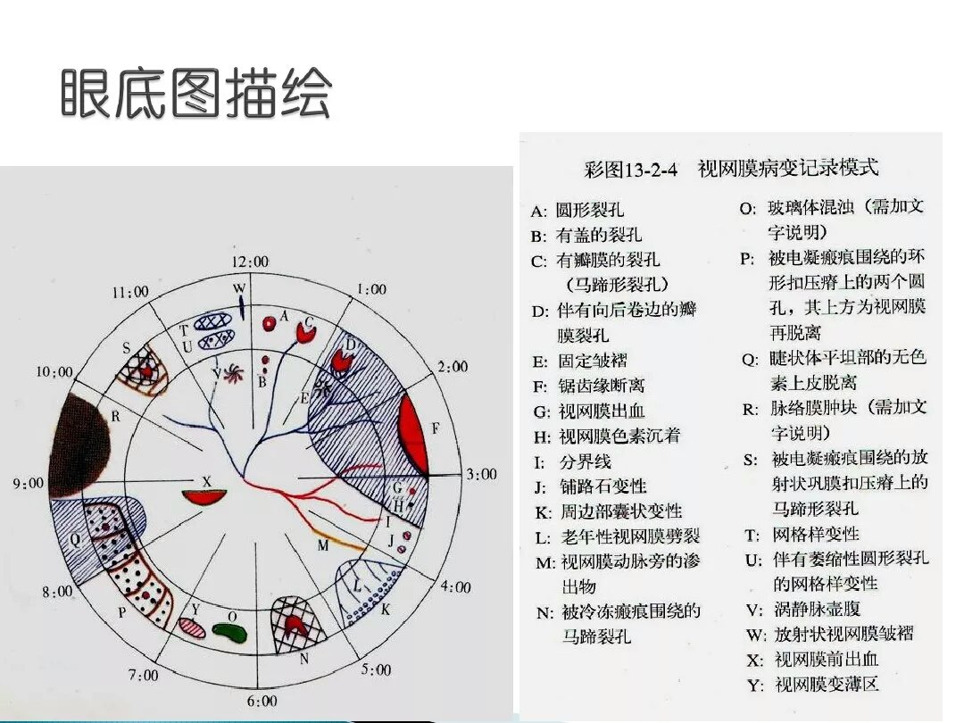 房角镜及三面镜检查