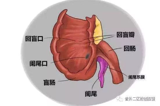 阑尾为一条细长的管道,远端为盲端,近端开口于盲肠.