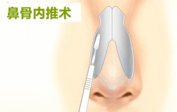 363_230 gif 动态图 动图