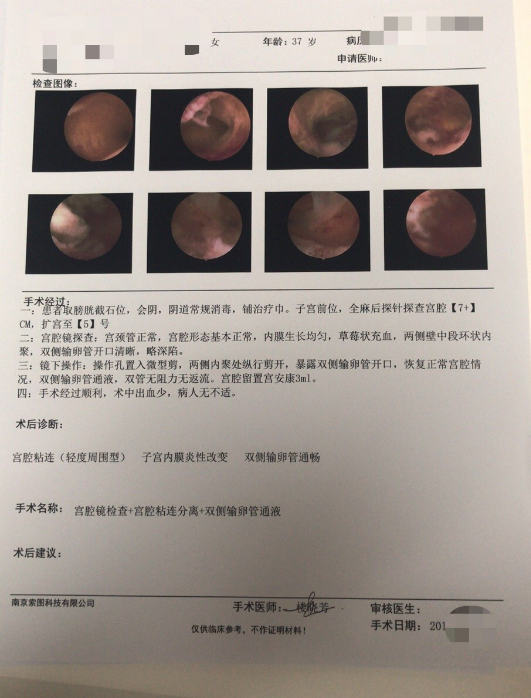 宫腔镜手术在生殖方面的优势二