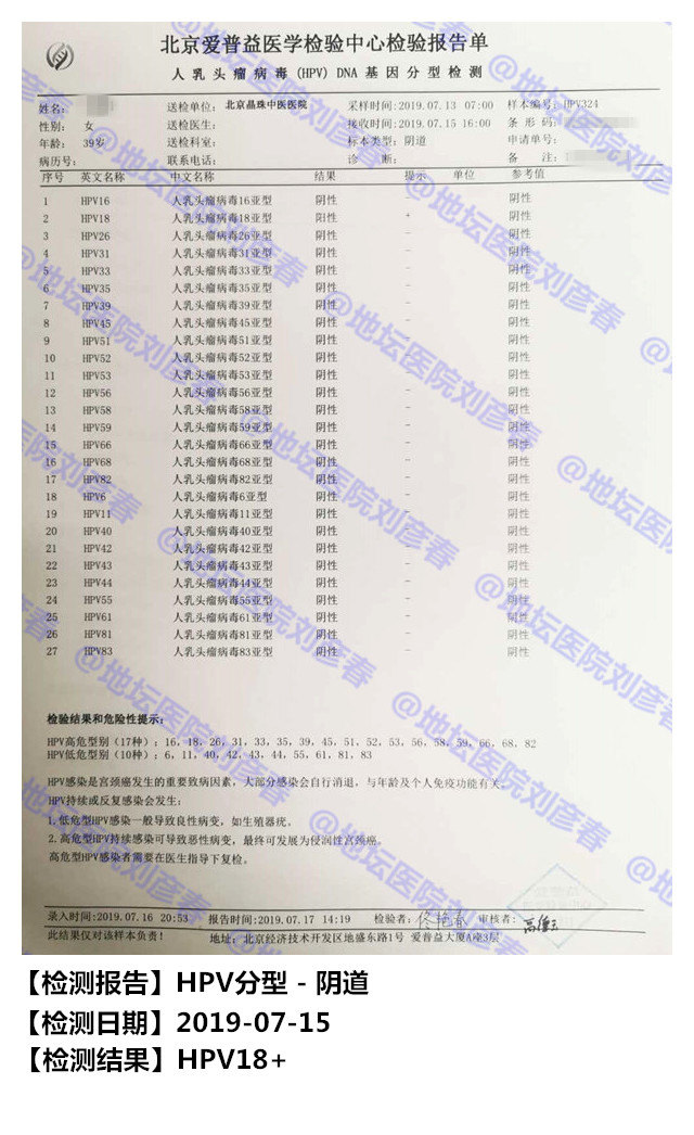 2,2019年7月份初次就诊,经检测外阴,肛周,阴道均检测出hpv18感染,并