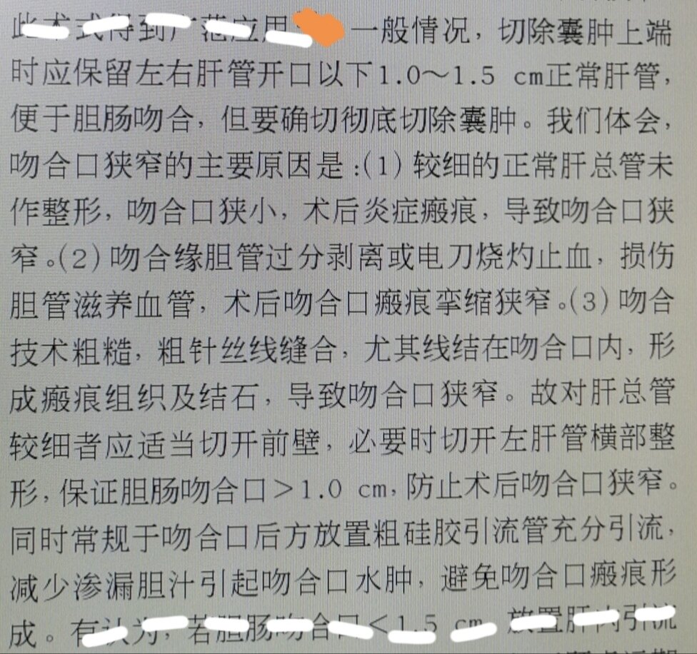 胆总管囊肿切除胆肠吻合术十五年后有何怪异之处