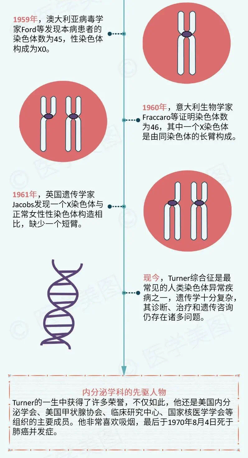 特纳综合征