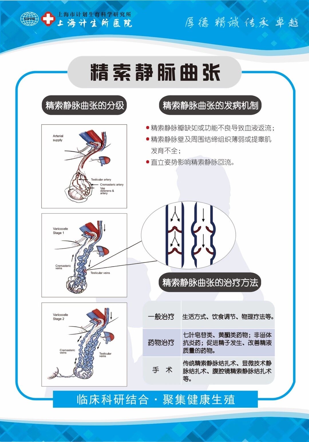 精索静脉曲张诊疗病例分享3