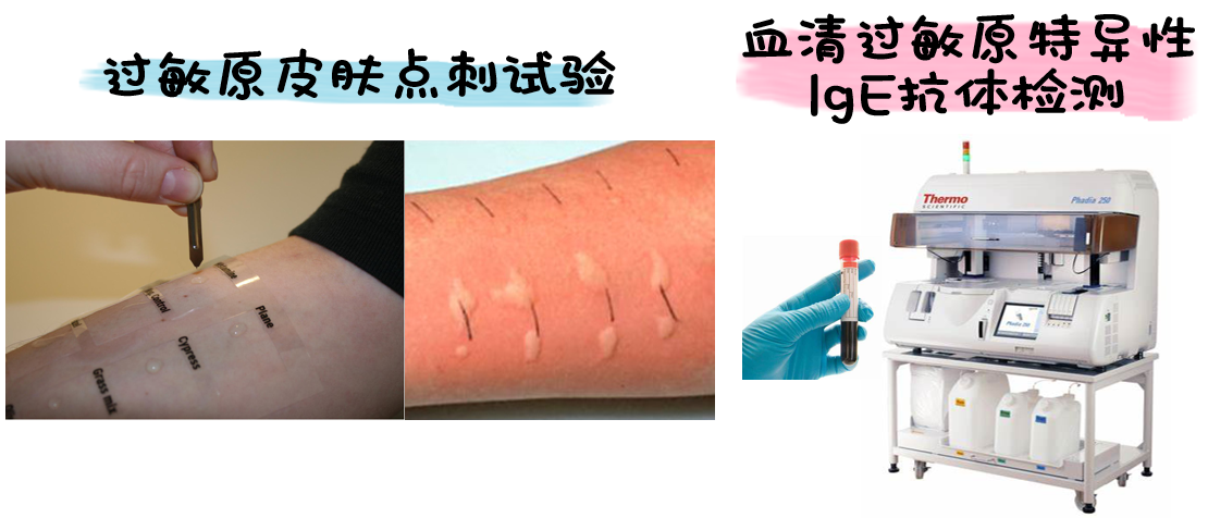 过敏原皮肤点刺试验 尘螨特异性ige抗体检测(抽血检查)