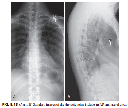 王祥瑞 > 怎么正确使用脊柱常规放射线检查(x线)标准正侧位片(如颈椎