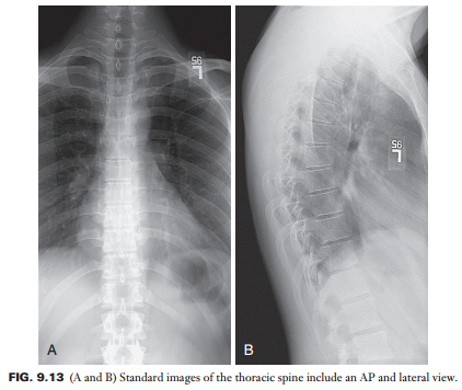 a b 示,标准的胸椎正位片,侧位片.