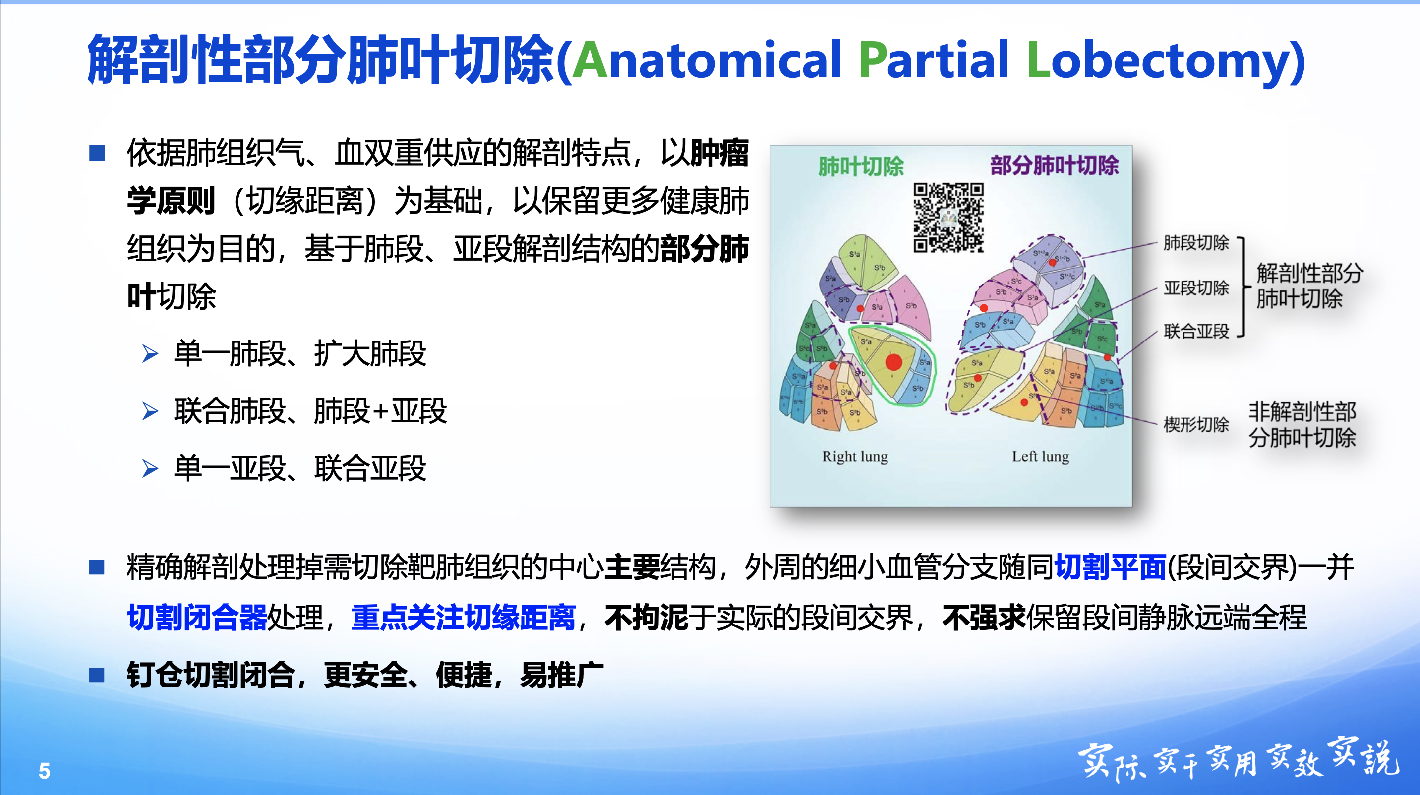 有磨玻璃成分的早期肺癌解剖性部分肺叶切除更微创