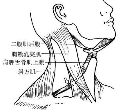 ①手法按摩:家长可先带患儿在专业的医院按摩,同时家长也可以学习按摩