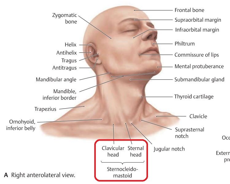锁骨周围主要有哪些肌肉韧带附着周围有哪些血管神经引起斜颈的胸锁