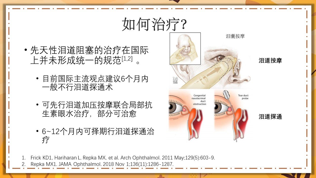 先天性泪道阻塞,泪道按摩的几件事