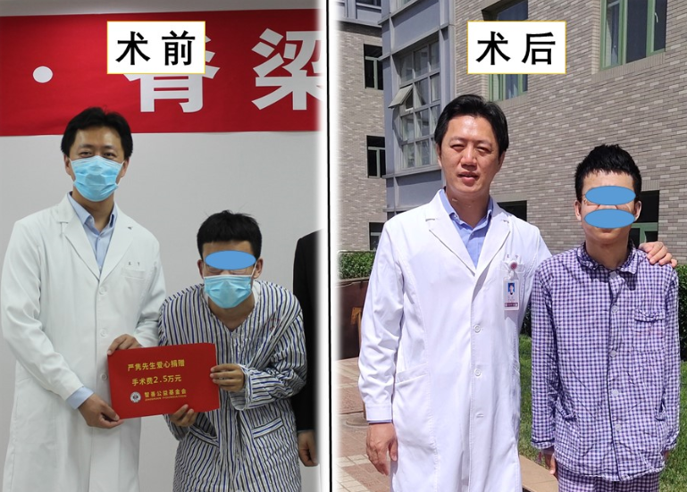 目前强直性脊柱炎驼背矫正手术已经非常成熟,所以患者可以放心选择