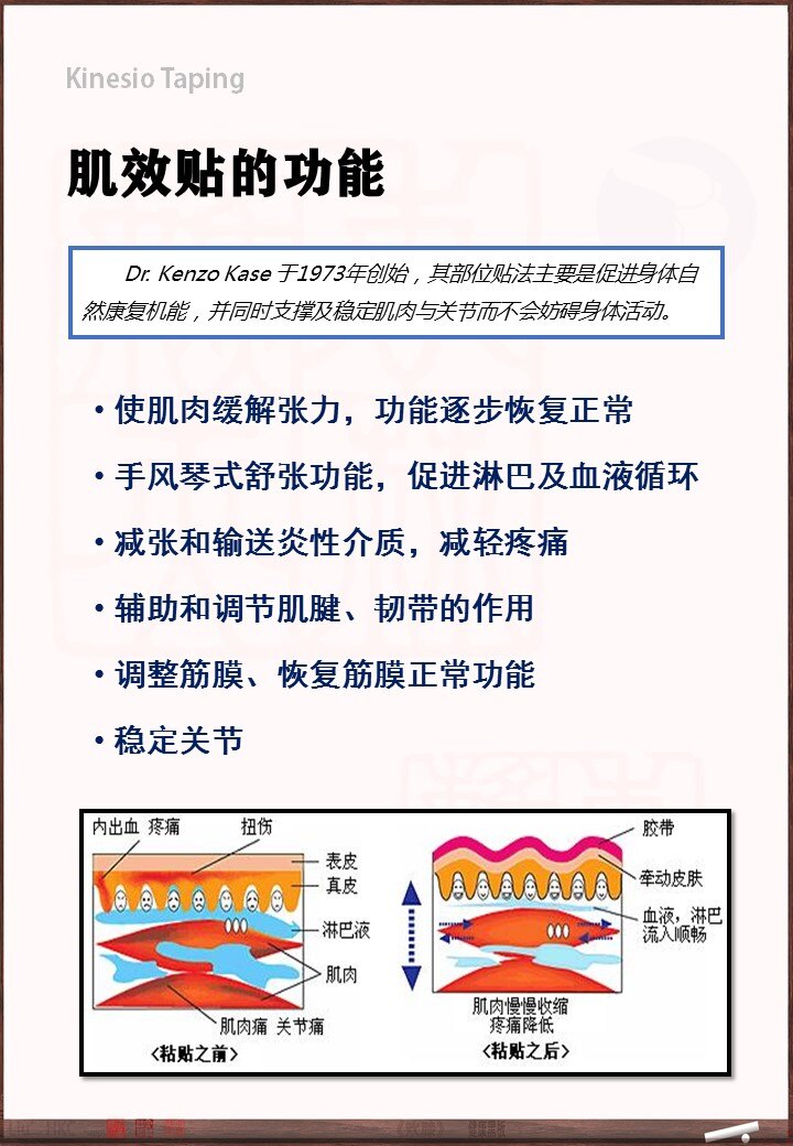 运动损伤小法宝肌效贴