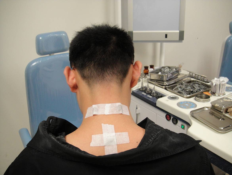 过敏性鼻炎的中医中药治疗
