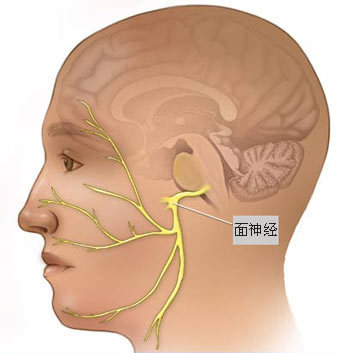 面部肌肉抽搐是否会导致面肌痉挛疾病的发生？