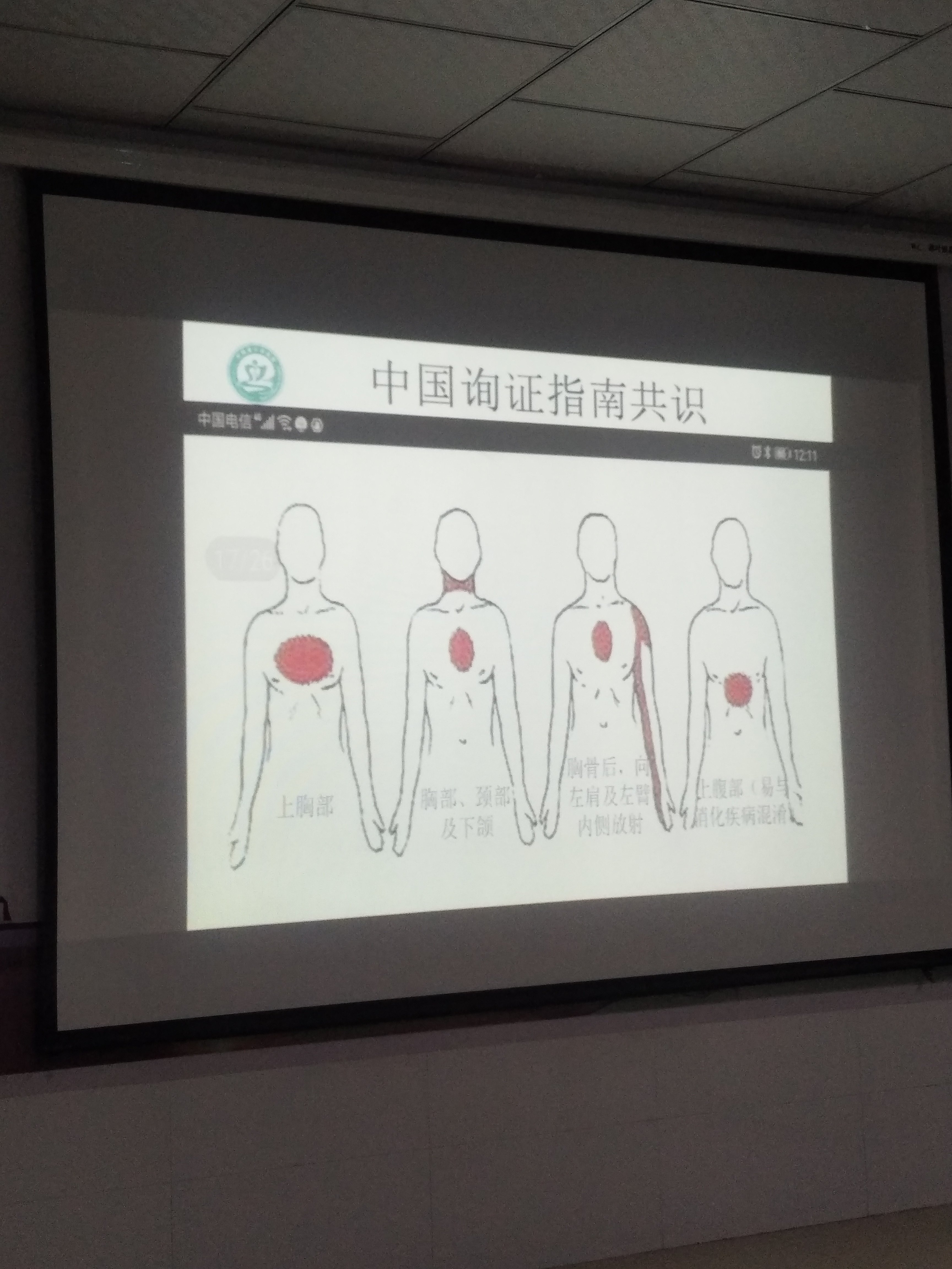 3,诱因:发作常由体力劳动或情绪激动,饱食,寒冷,吸烟,心动过速,休克