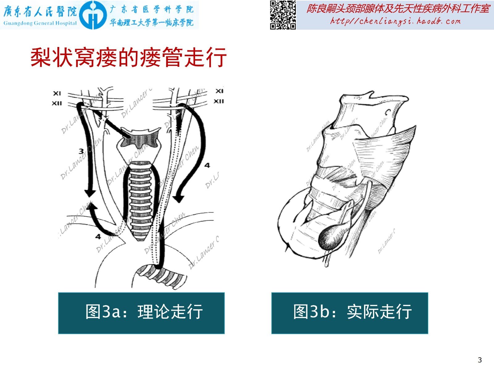 医学科普梨状窝瘘的左邻右里