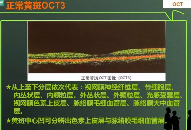 oct结果解读ppt