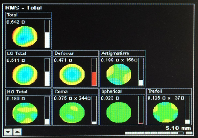 原创 角膜地形图&像差原理解读(下)