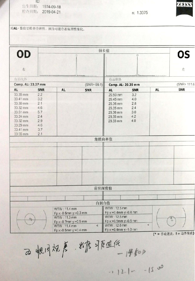 【案例分享】当icl遇上"小"角膜(附视频)