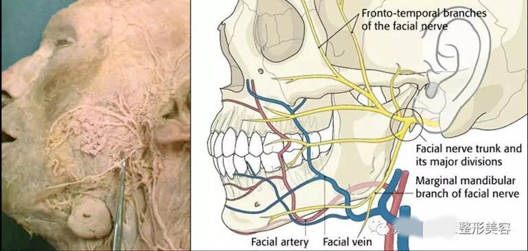 和面部(口角囊袋,双下巴,火鸡纹)的关系由于下颌缘支位于颈阔肌深面