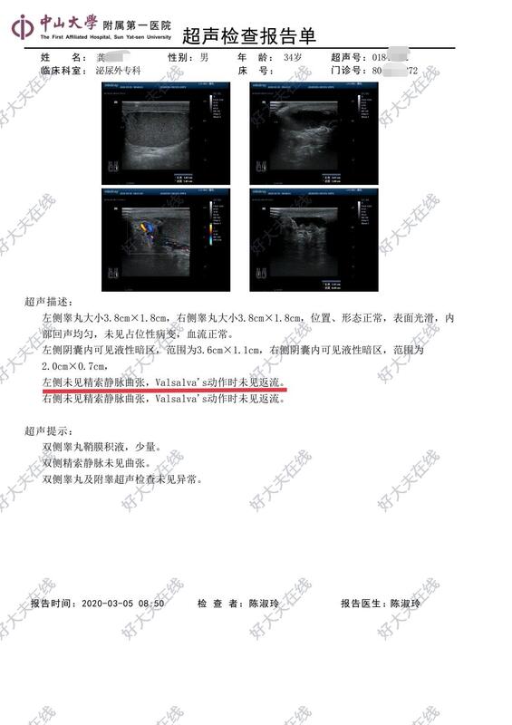 显微镜精索静脉结扎术_精索静脉曲张 好大夫在线
