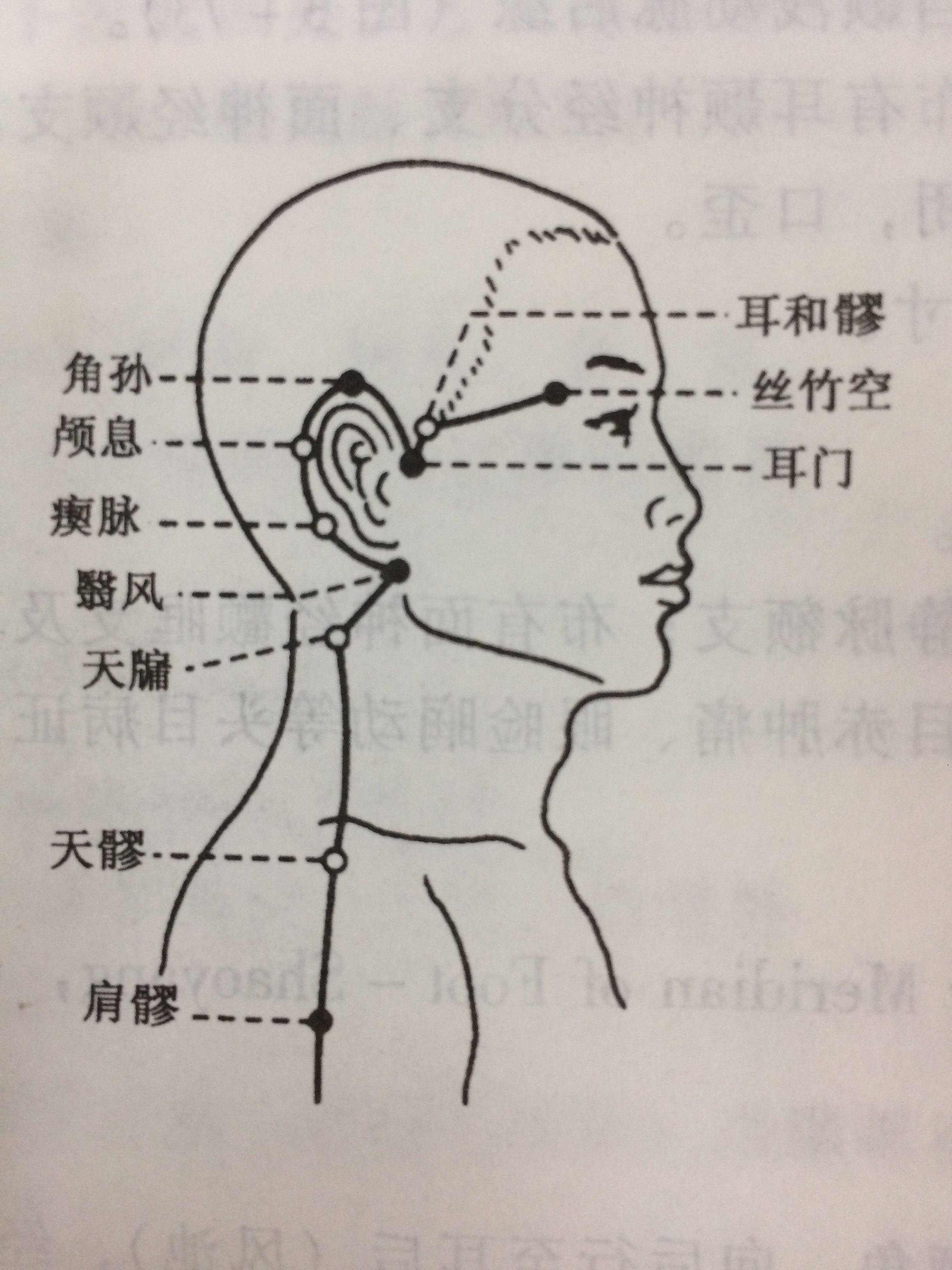 呃逆的一针疗法