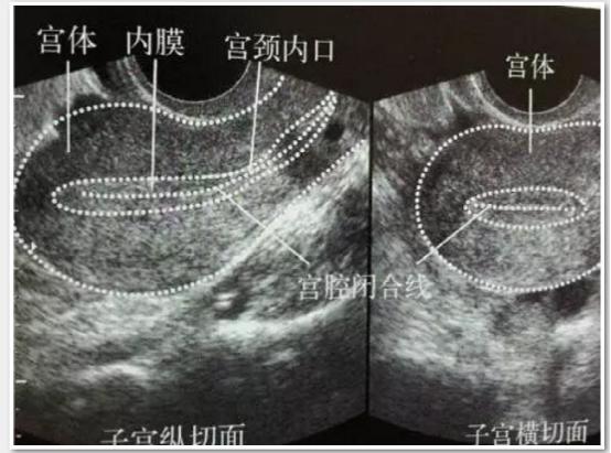 子宫内膜厚度与妊娠率