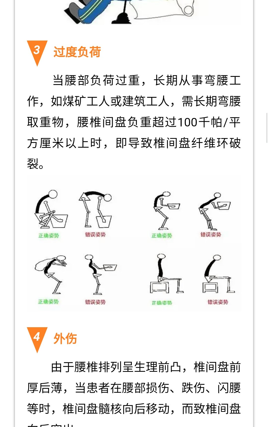 腰椎锻炼方法