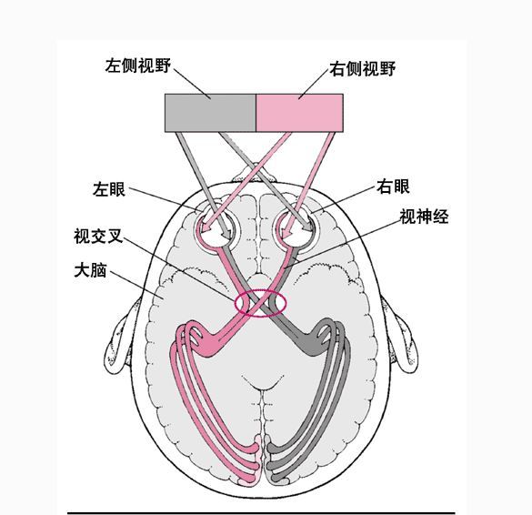 垂体和视神经之间的距离很小,垂体瘤可以向鞍上发展而压迫视交叉和视