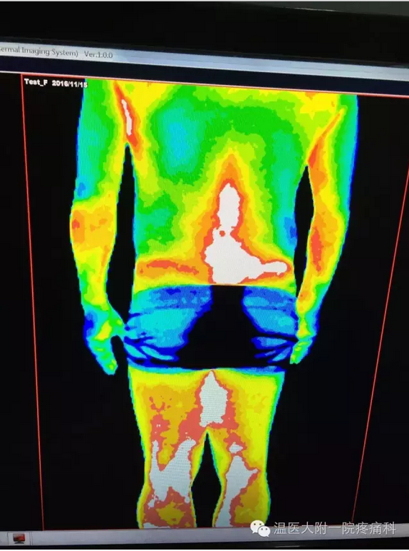 医用红外热成像诊断技术