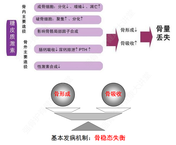 糖皮质激素引起的骨质疏松,怎样早发现,早治疗?