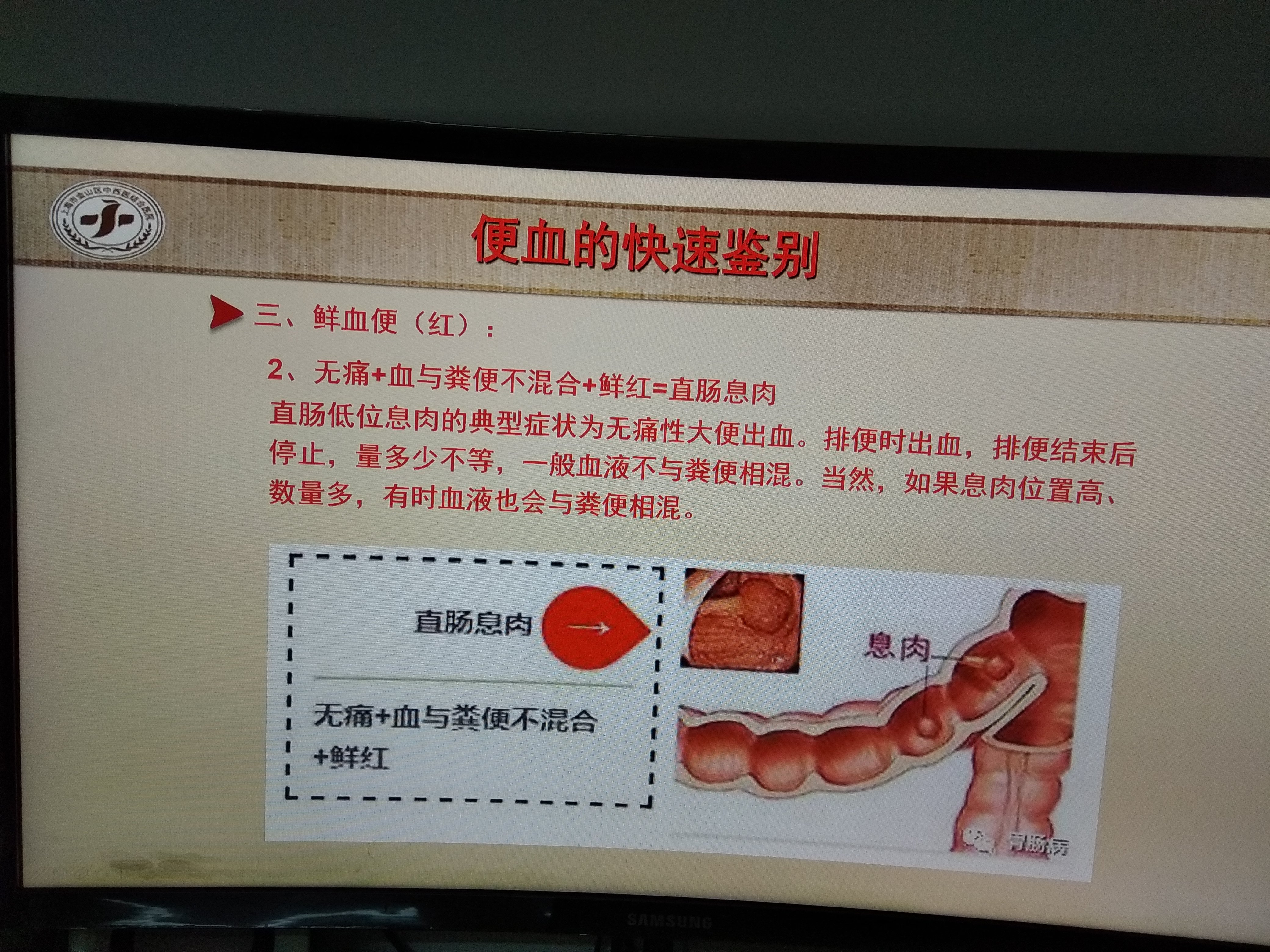 直肠息肉引起的便血特点(建议肠镜检查排除其他疾病)